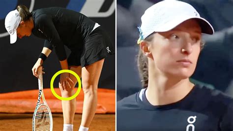 out of context iga świątek|Iga Swiatek hobbled in Rome during 'awful' scenes before French Open.